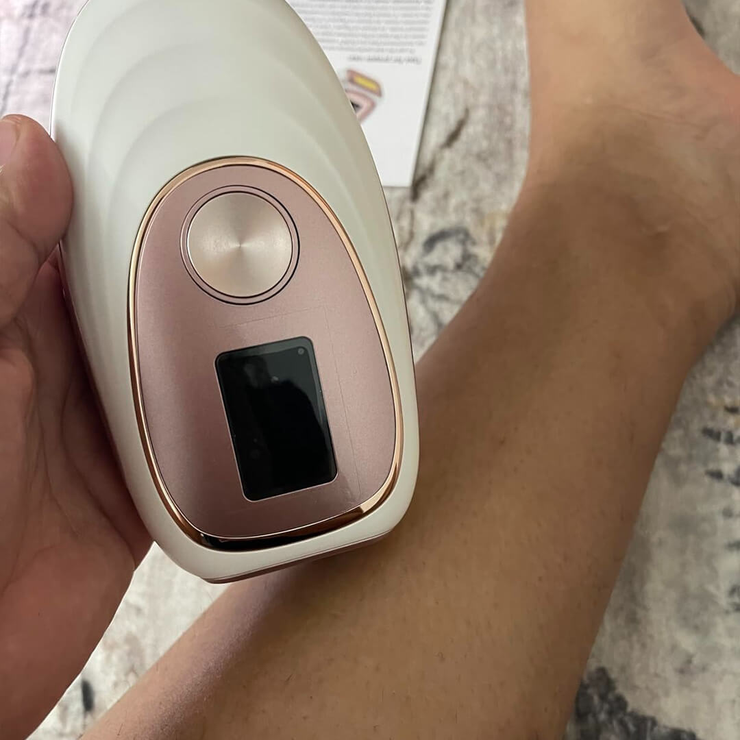 LunaSkin™ Lumière (IPL Hair Removal)
