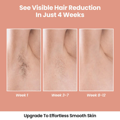 LunaSkin™ Lumière (IPL Hair Removal)